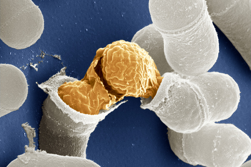 Illustration for article titled The Astounding And Horrific World As Seen Under A Microscope